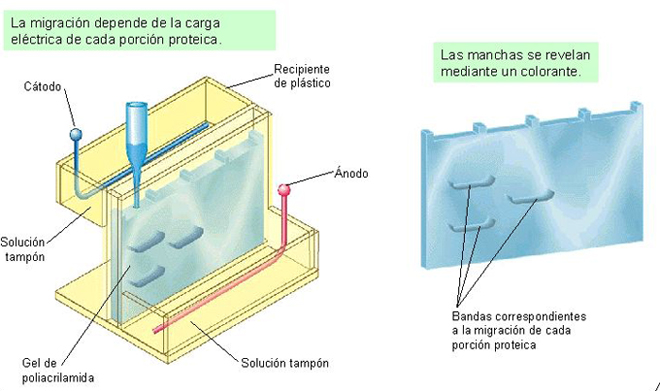 electroforesis